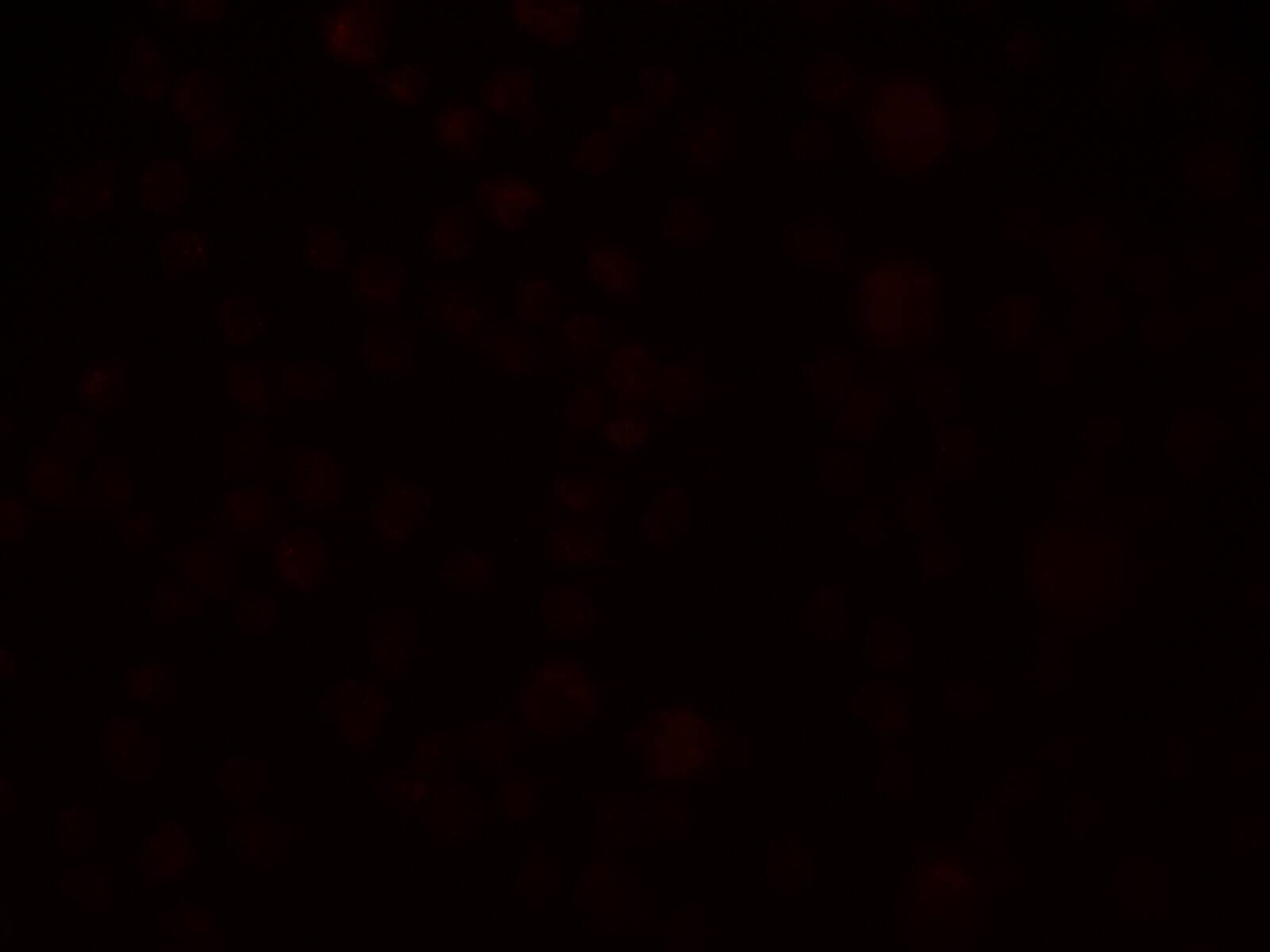 SLAIN1 Antibody - BSA Free