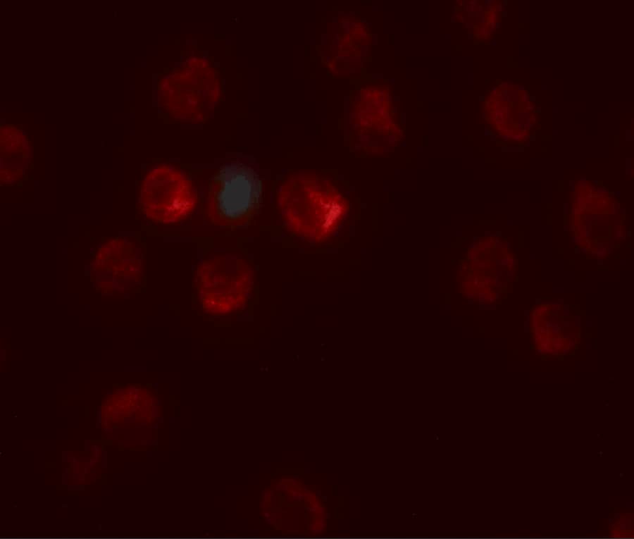 TCTEX1D1 Antibody - BSA Free