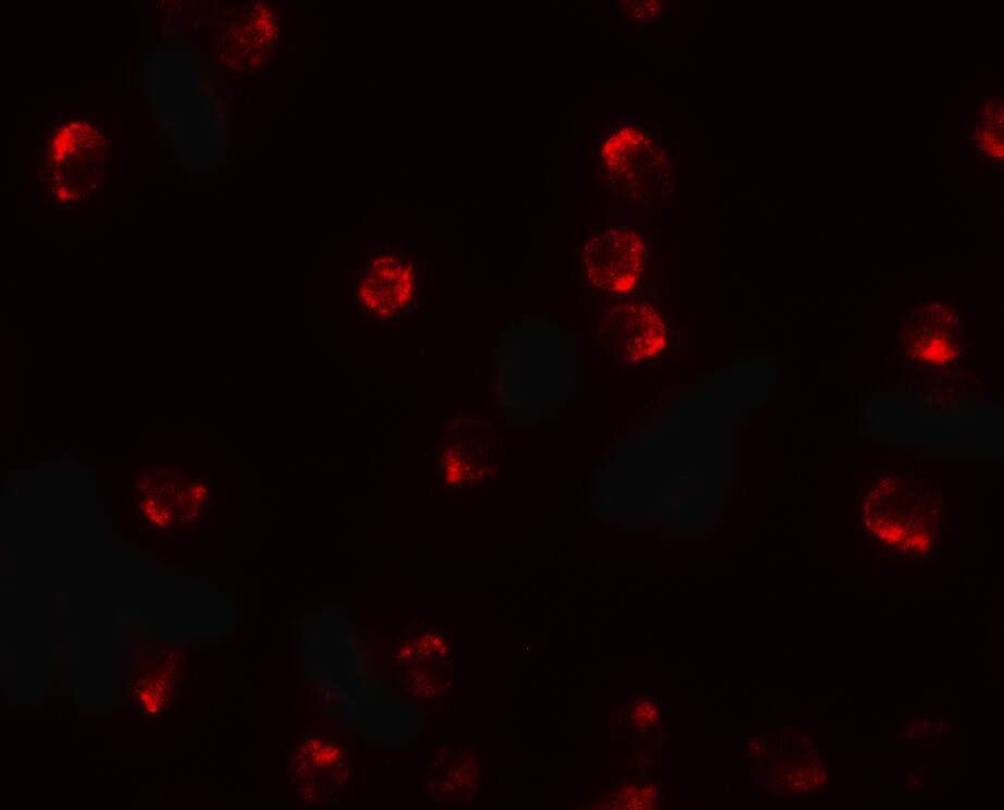 TCTEX1D2 Antibody - BSA Free