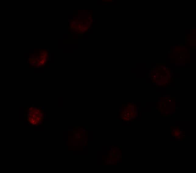 SLC35D3 Antibody - BSA Free