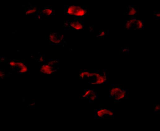 TMEM18 Antibody - BSA Free