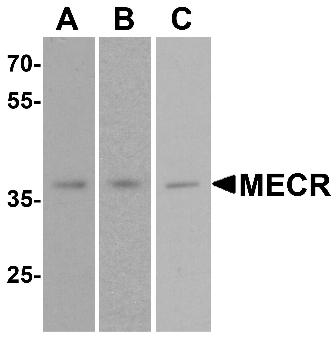 MECR Antibody - BSA Free