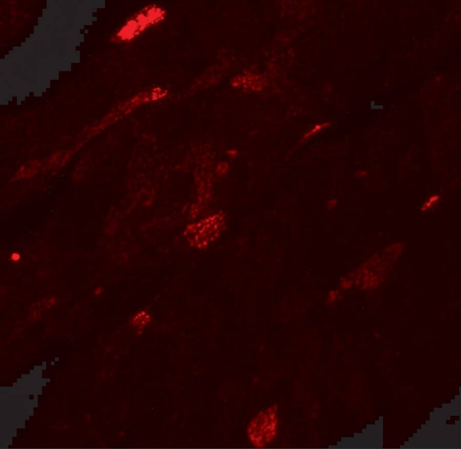Transglutaminase 5 Antibody - BSA Free