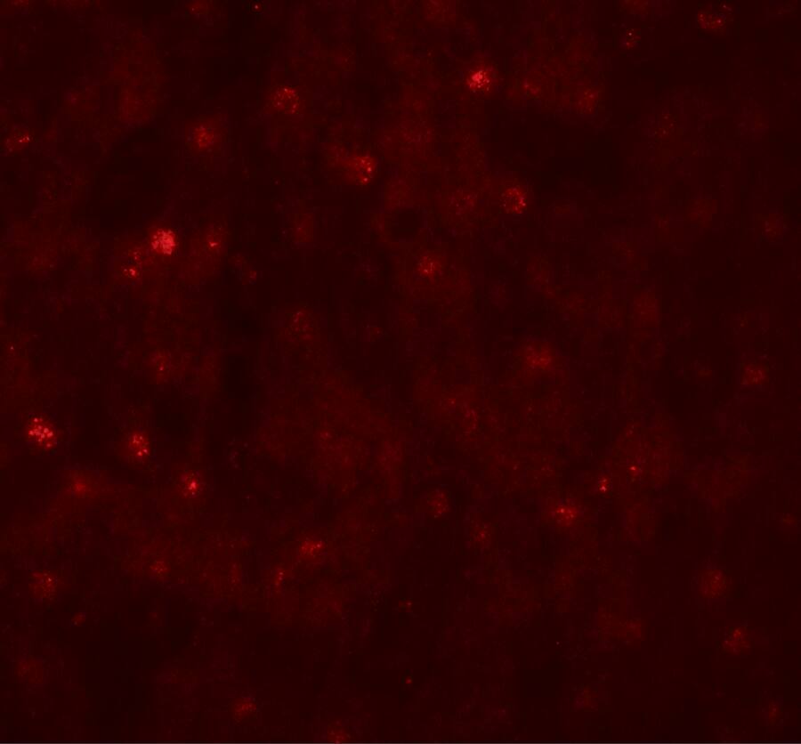 TCTEX1D4 Antibody - BSA Free