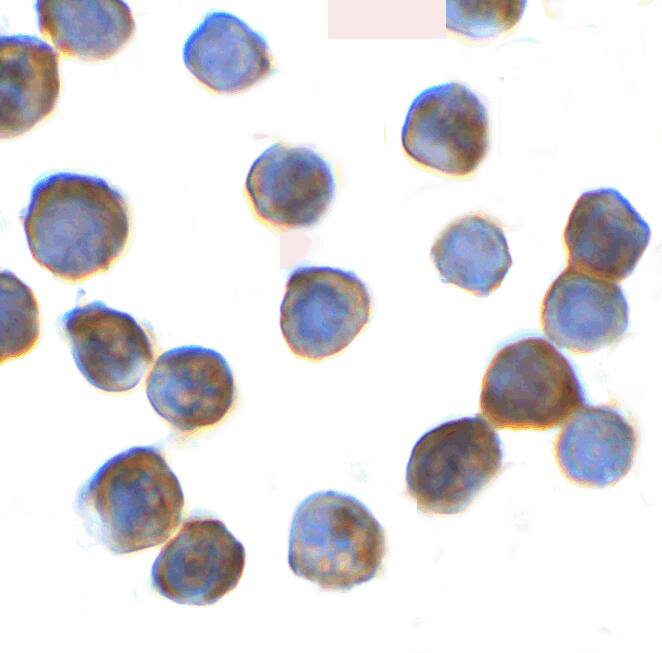 Thyroid receptor-interacting protein 12 Antibody - BSA Free