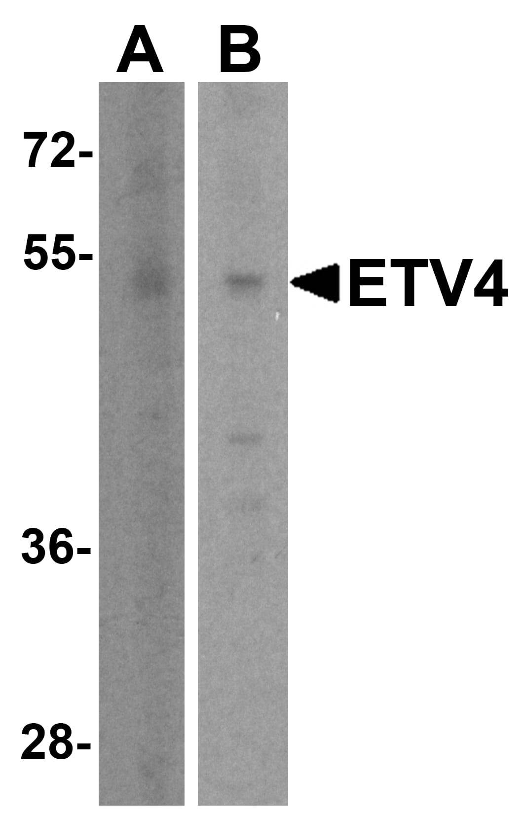 Pea3 Antibody - BSA Free