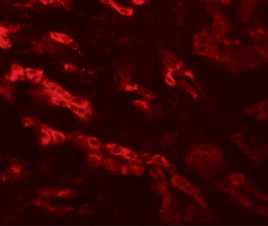 ZNF336 Antibody - BSA Free