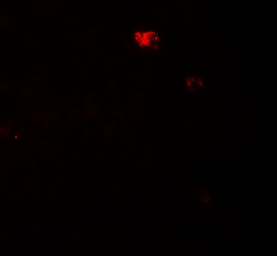 PPM1D Antibody - BSA Free