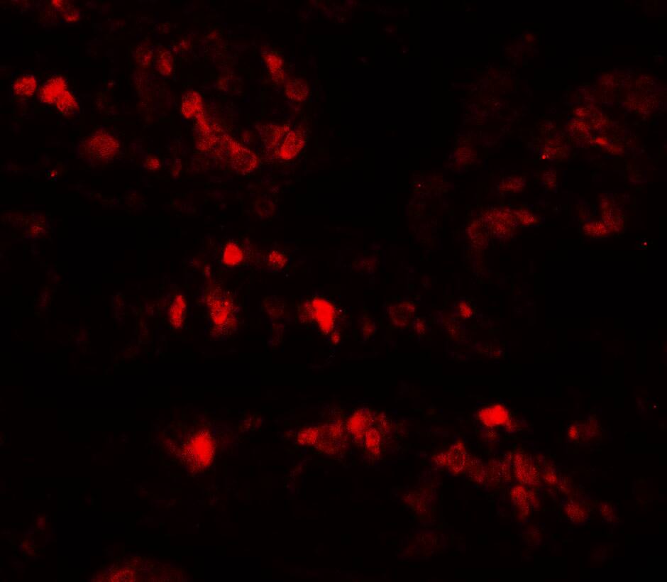 AIMP2 Antibody - BSA Free