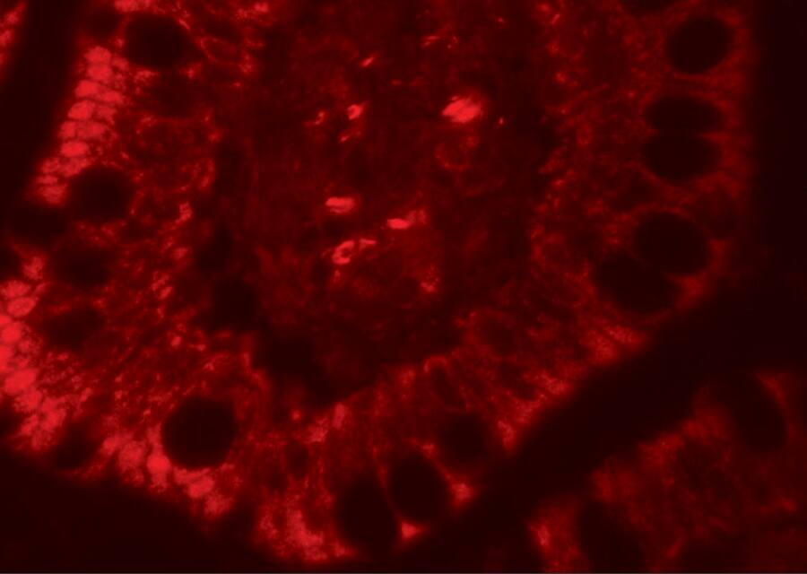 Roquin Antibody - BSA Free