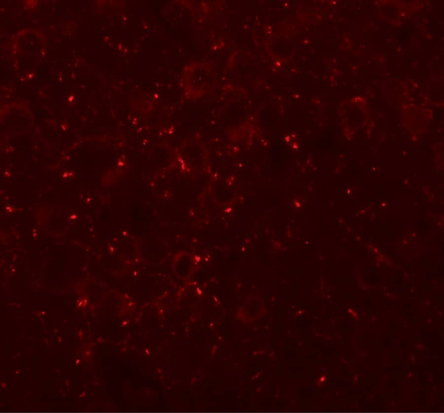 CCDC141 Antibody - BSA Free