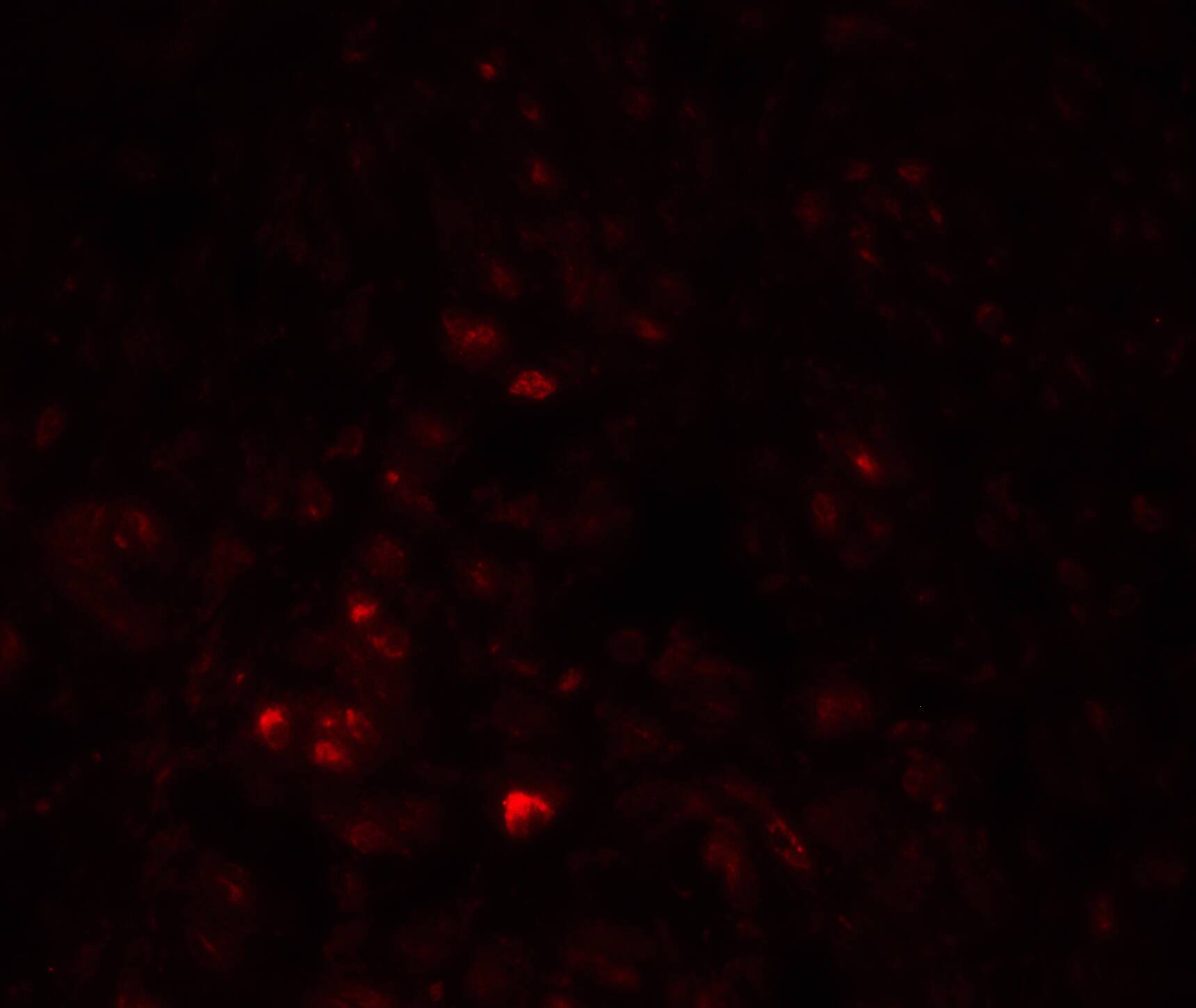 CAPC / LRRC26 Antibody - BSA Free