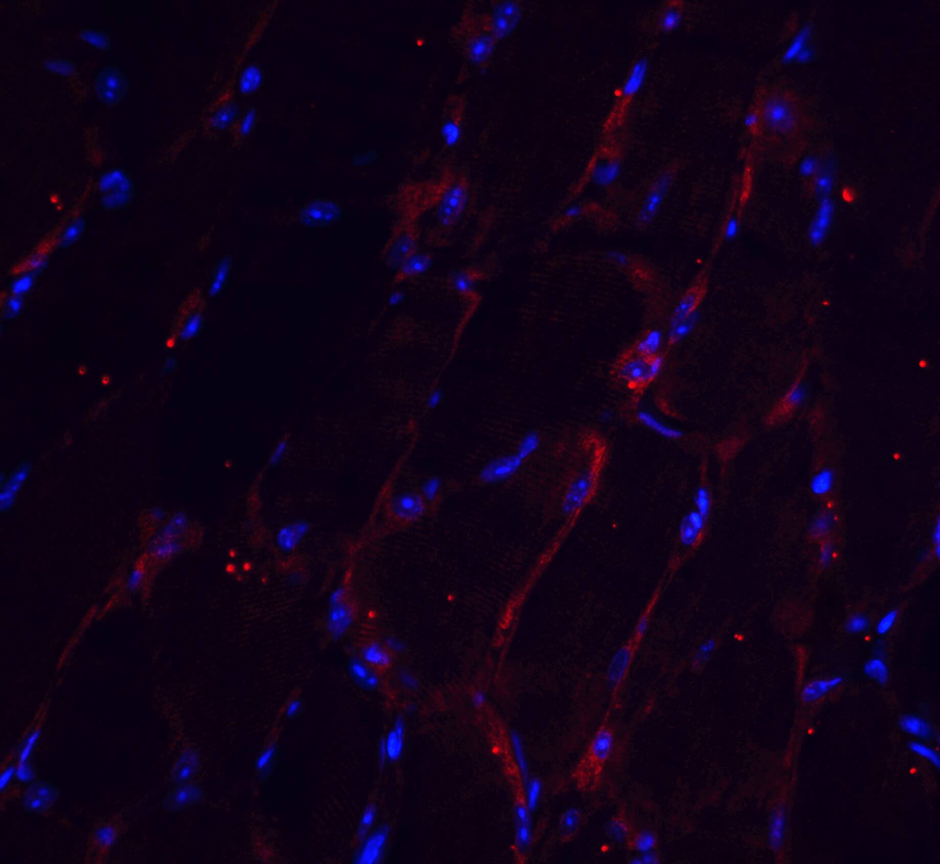 CHADL Antibody - BSA Free