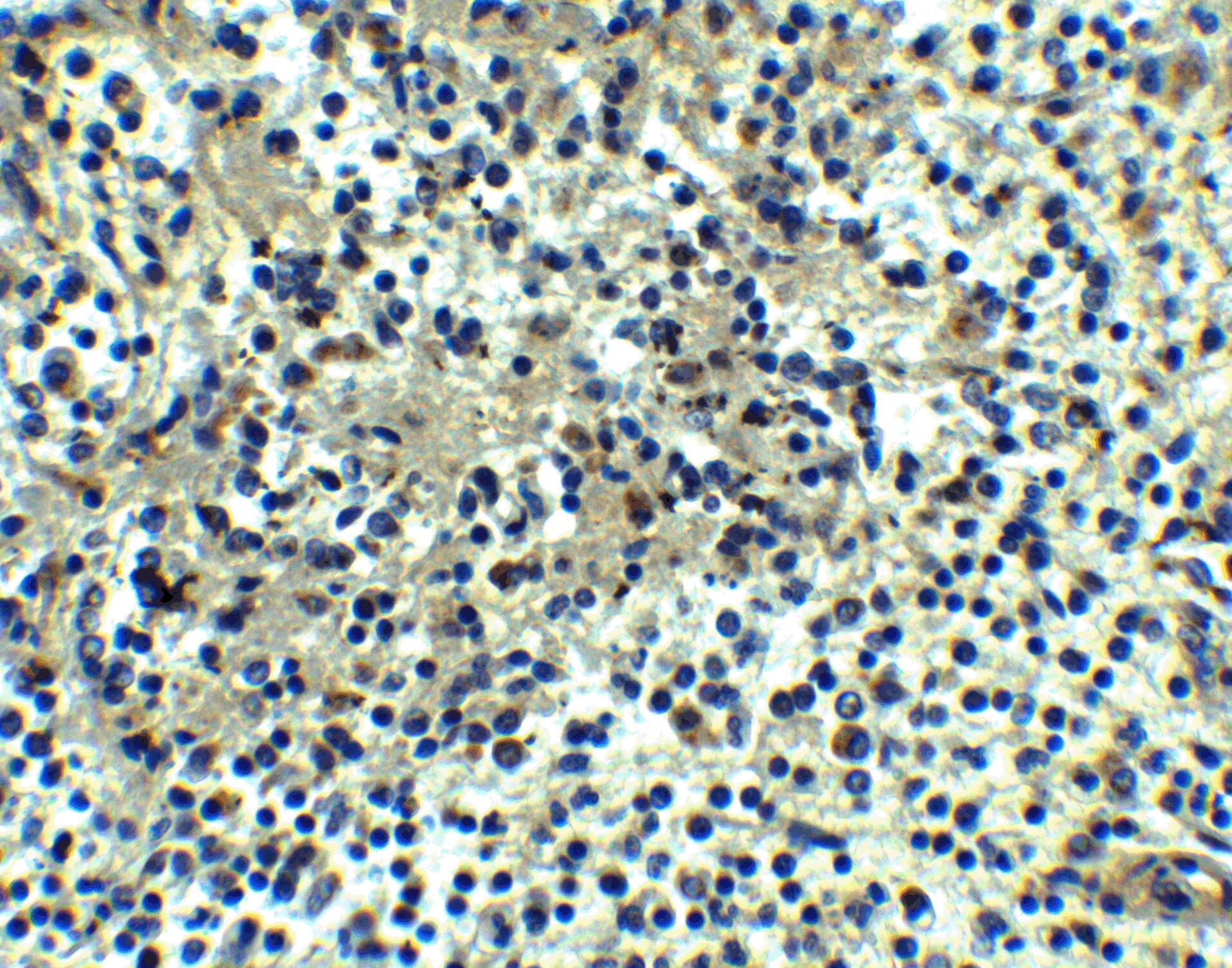 DEPDC1B Antibody - BSA Free