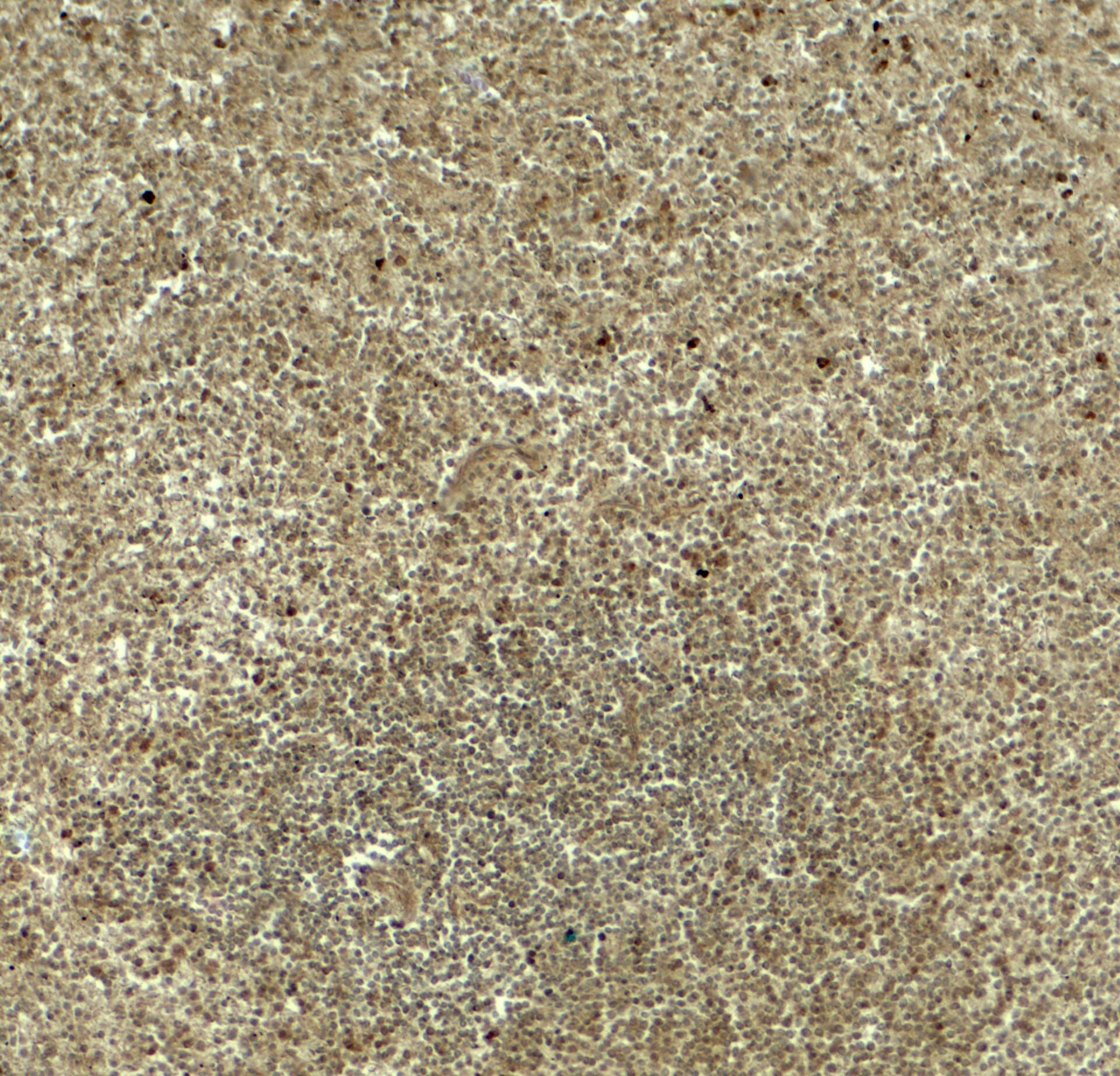 DTX4 Antibody - BSA Free