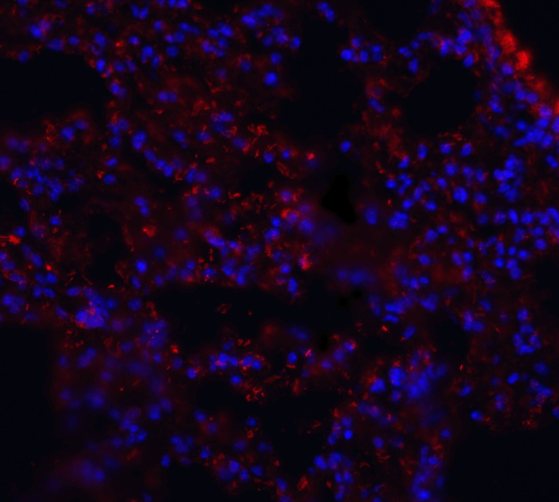 MFSD2 Antibody - BSA Free
