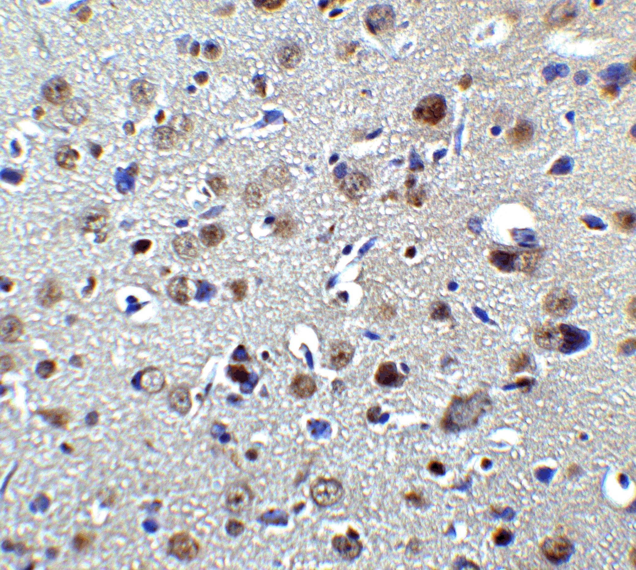 PLAGL2 Antibody - BSA Free