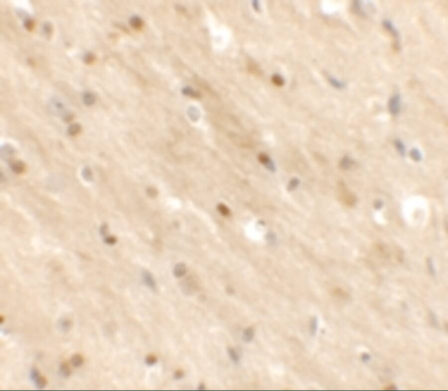 TMEM59L Antibody - BSA Free