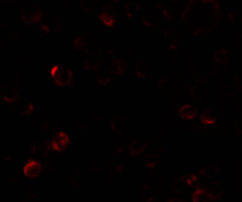 Laforin/EPM2A Antibody - BSA Free