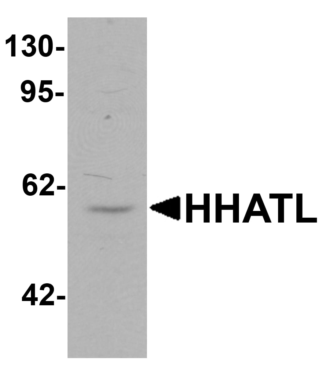 HHATL Antibody - BSA Free