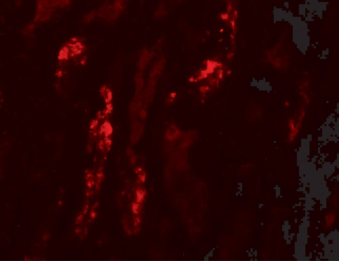 ANKRD15 Antibody - BSA Free