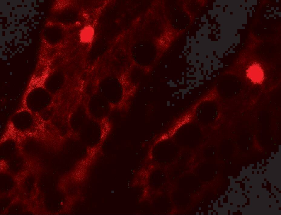 MTERFD2 Antibody - BSA Free