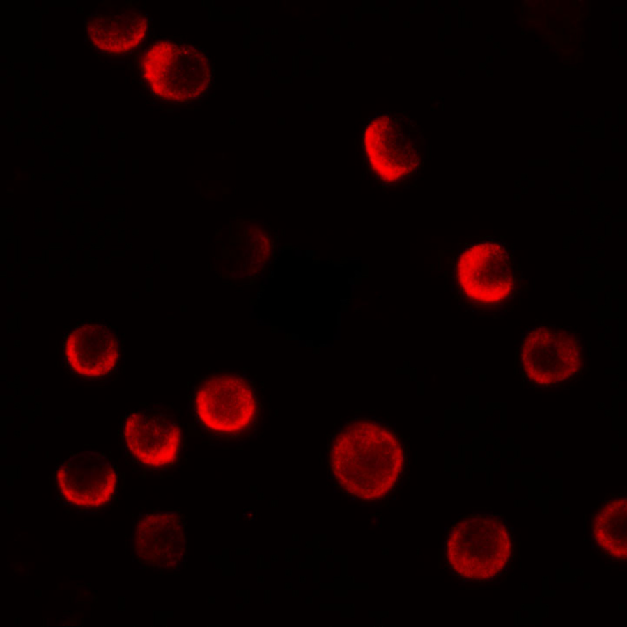 CASKIN2 Antibody - BSA Free