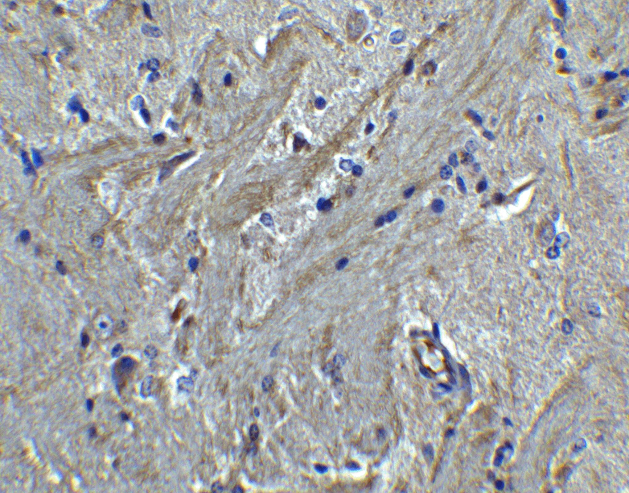 PACS2 Antibody - BSA Free