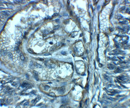 ENT2 Antibody - BSA Free