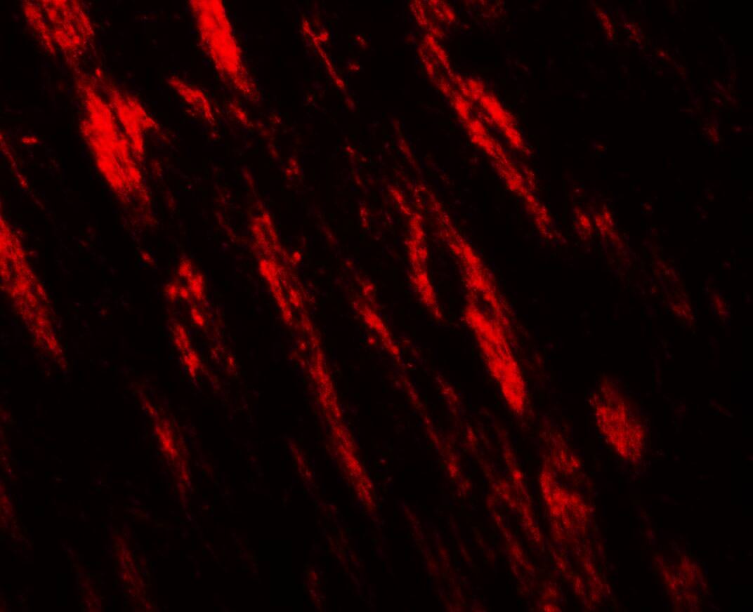 RNF70 Antibody - BSA Free