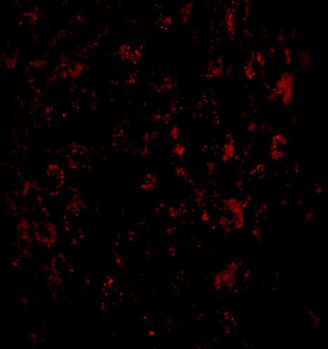 MACC1 Antibody - BSA Free