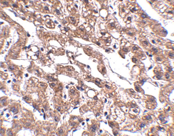 MACC1 Antibody - BSA Free