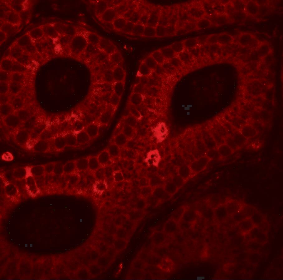 SPINK2 Antibody - BSA Free