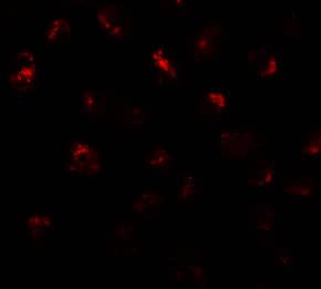 PRR5L Antibody - BSA Free