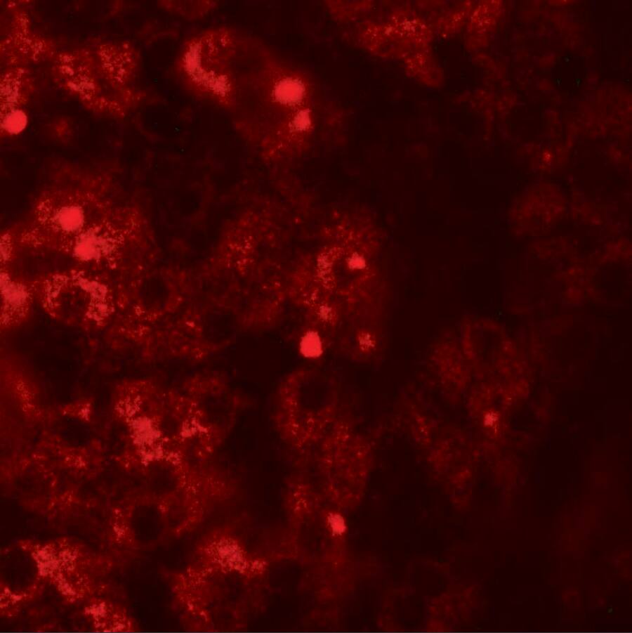 TMEM106B Antibody - BSA Free