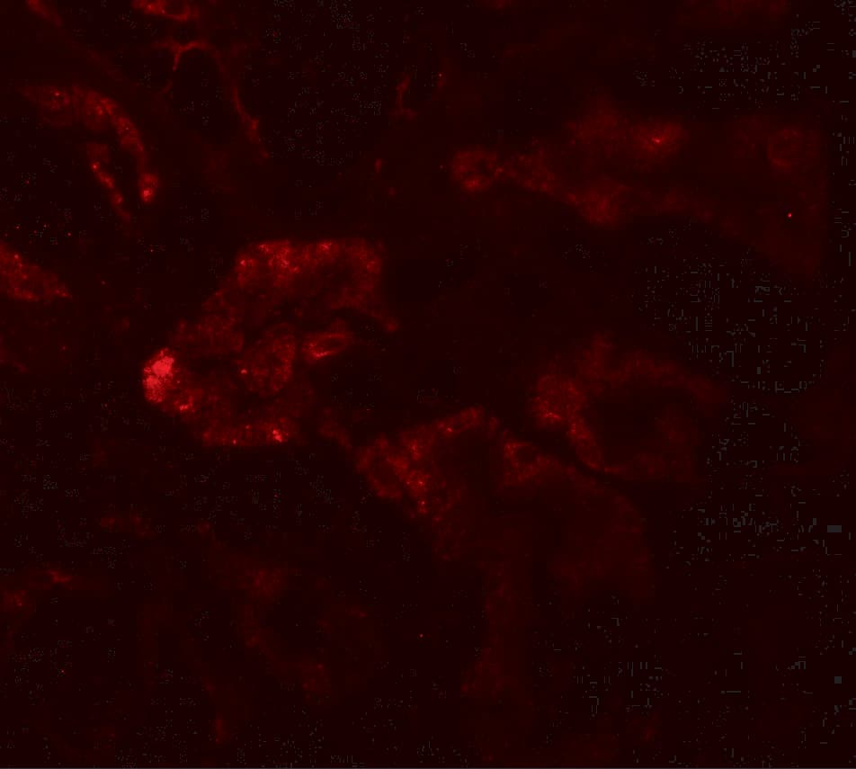 RAB21 Antibody - BSA Free