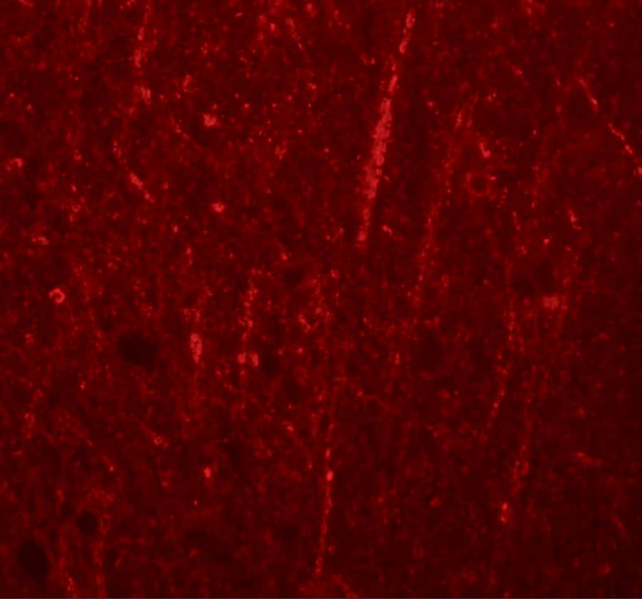 Preso/FRMPD4 Antibody - BSA Free