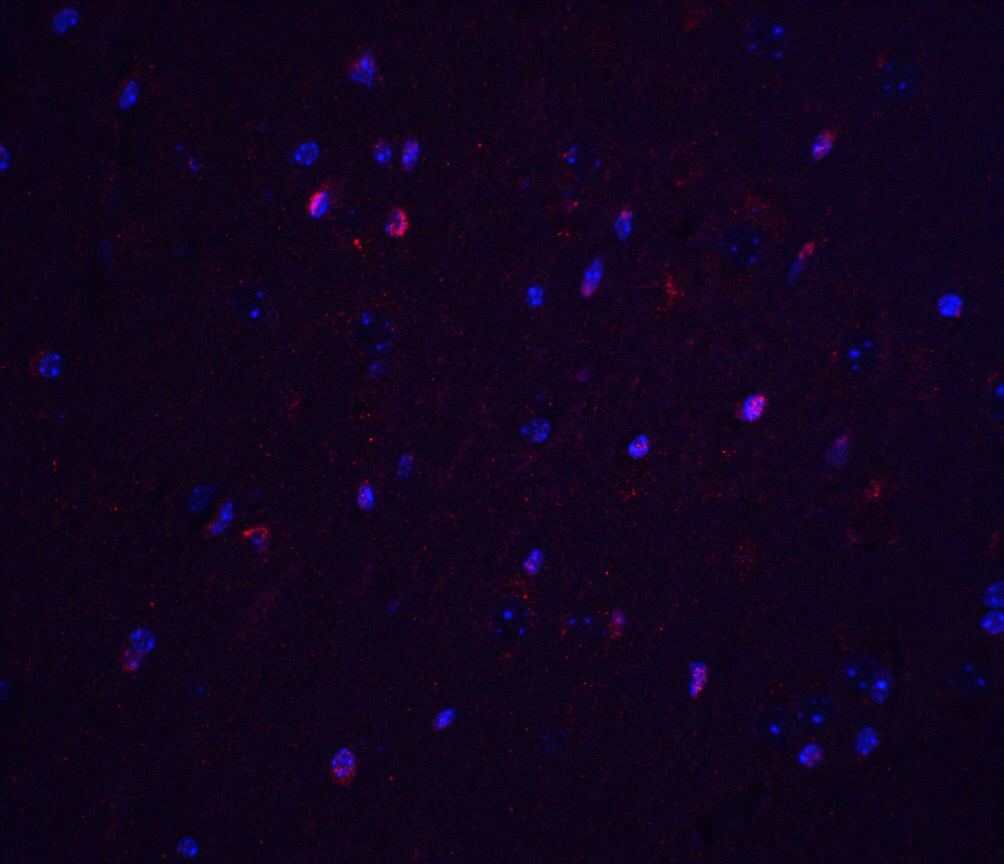TNFAIP1 Antibody - BSA Free