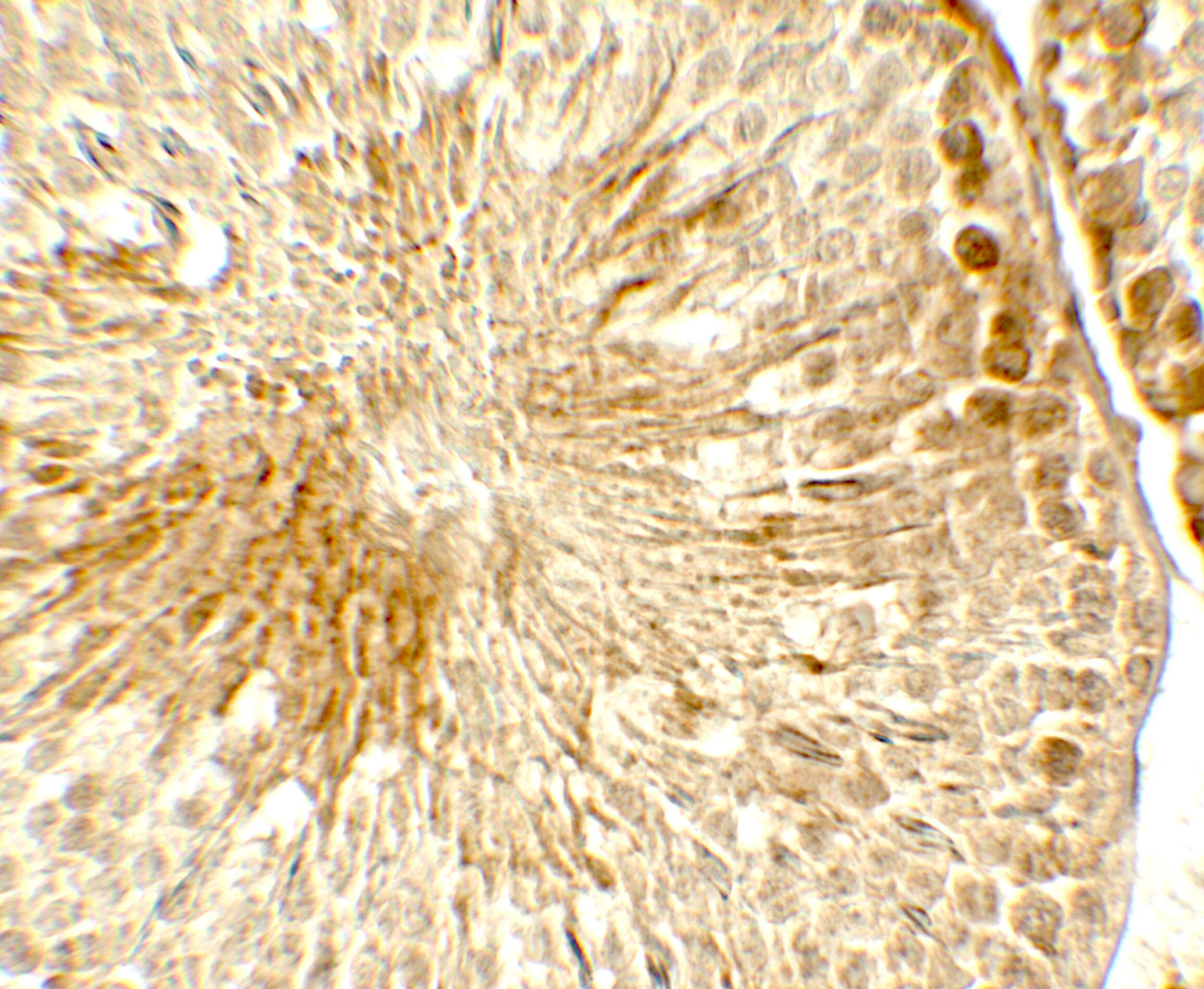 TOPAZ1 Antibody - BSA Free