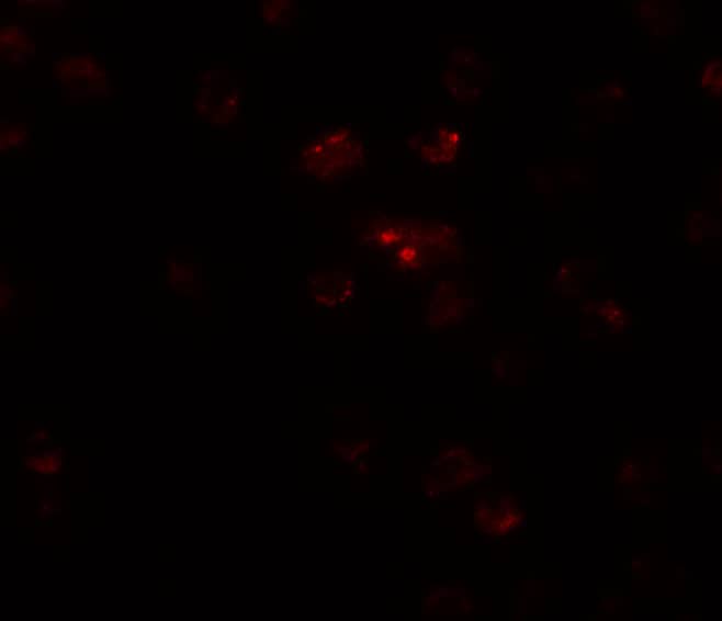 TSHZ2 Antibody - BSA Free