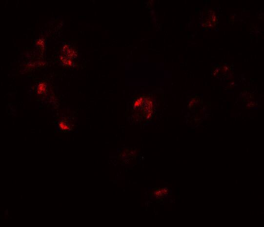 ZNF821 Antibody - BSA Free