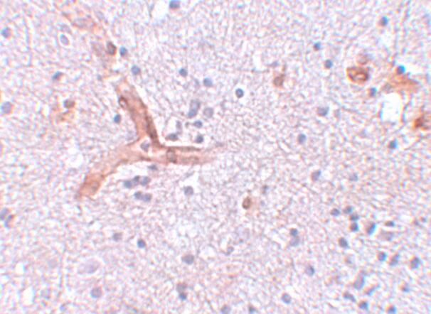 ZC3H12C Antibody - BSA Free