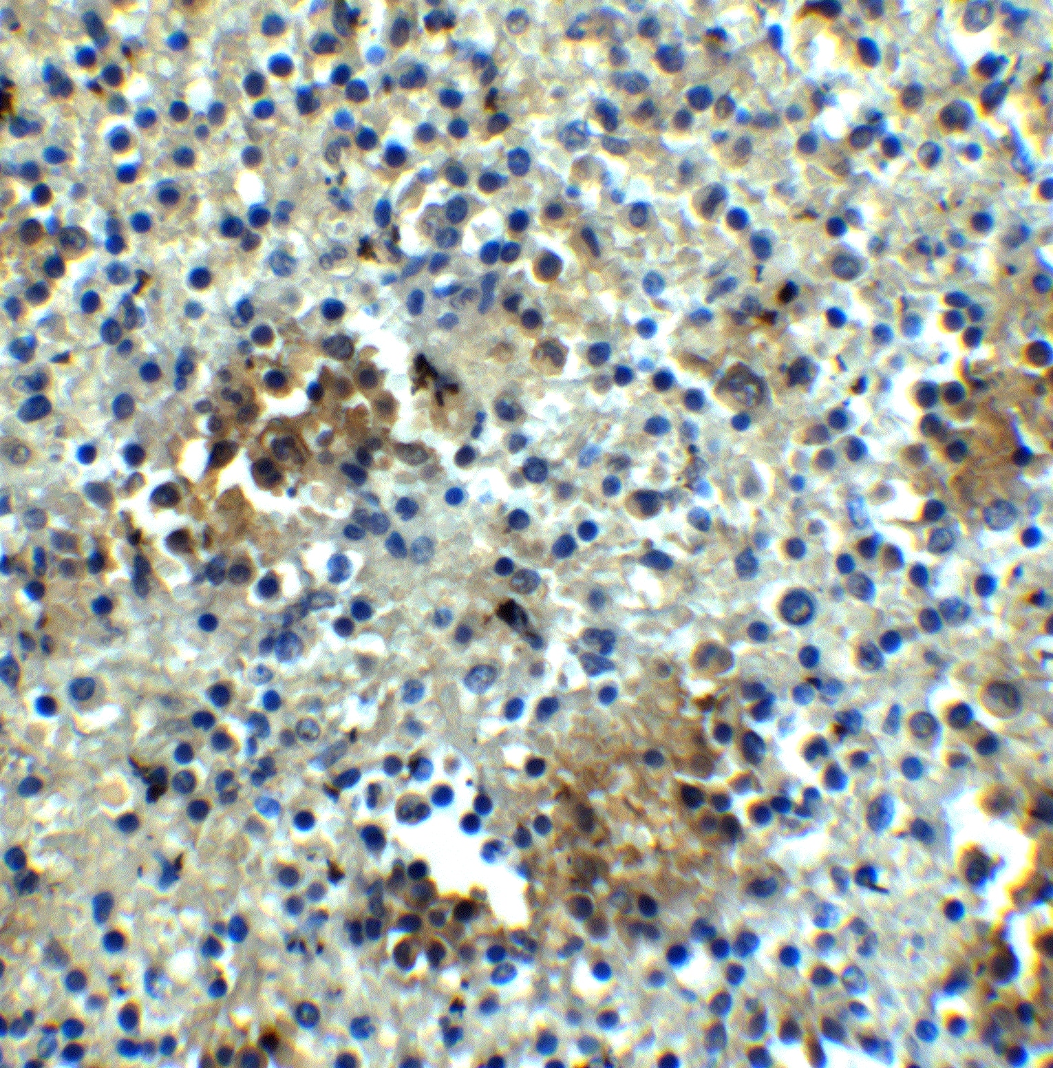 ABCA7 Antibody - BSA Free