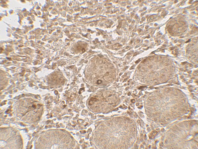 LAMTOR1 Antibody - BSA Free