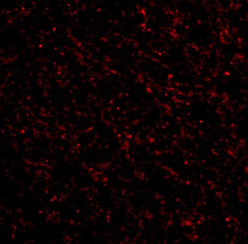 NK3R/TACR3/Neurokinin B Receptor Antibody - BSA Free