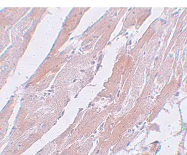 CCDC47 Antibody - BSA Free