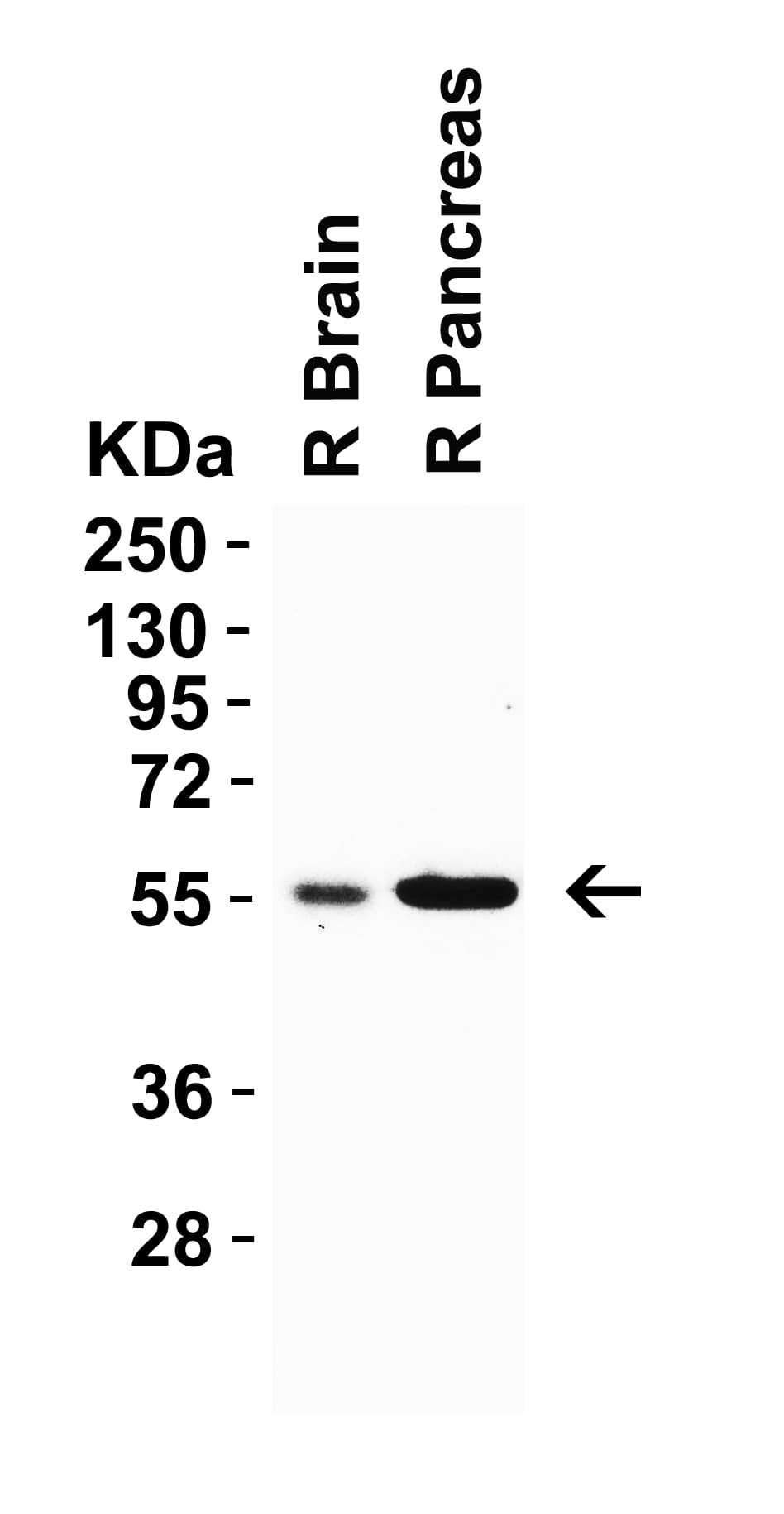 CRBN Antibody - BSA Free