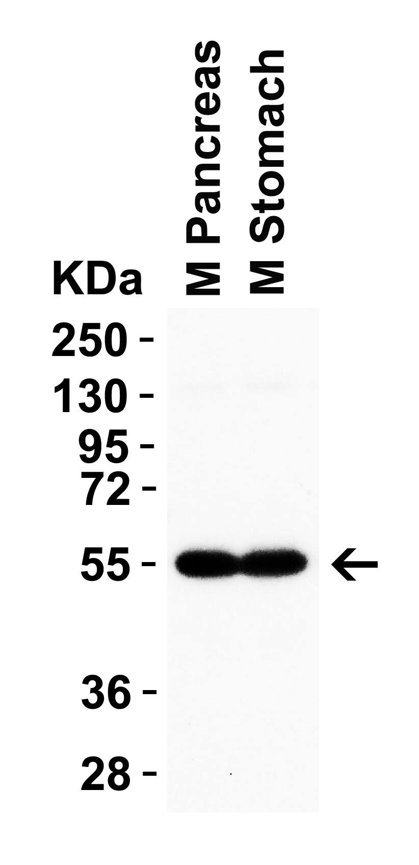 CRBN Antibody - BSA Free