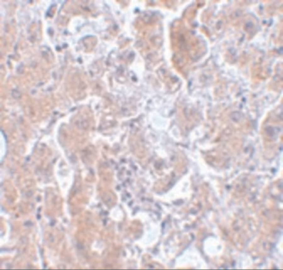 ELOVL7 Antibody - BSA Free