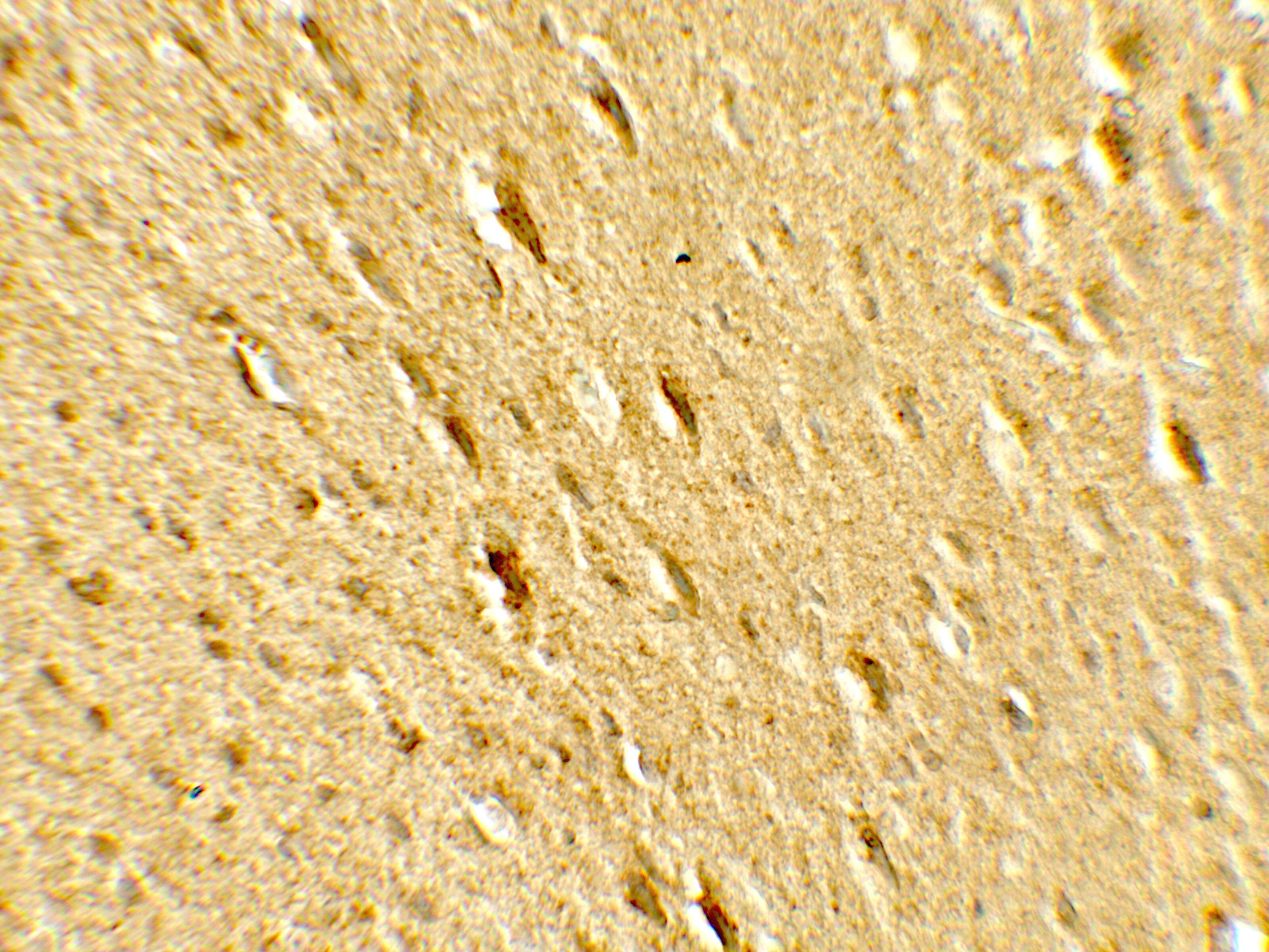 GATE-16/GABARAPL2 Antibody - BSA Free